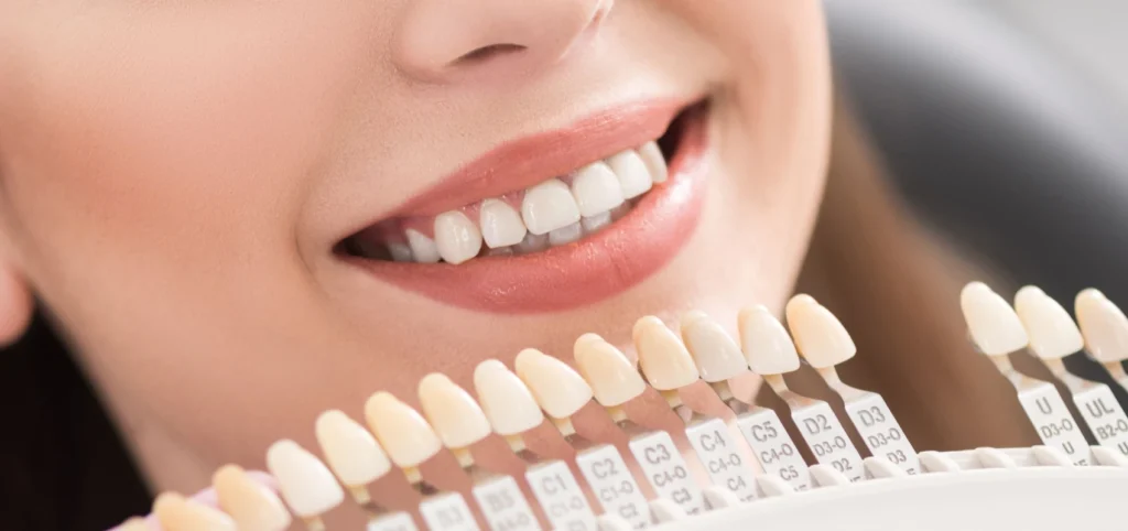 facettes dentaires dentiste mulhouse facettes dentaires dentiste mulhouse Omnipratique Chirurgiens-dentistes à Mulhouse