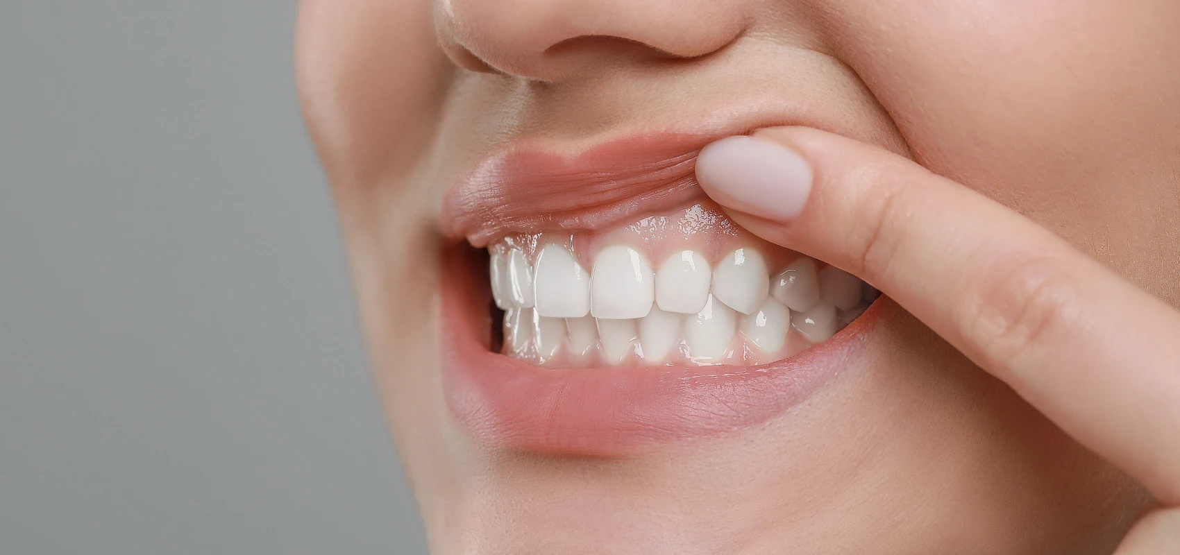 soins gencives Soins des gencives Chirurgiens-dentistes à Mulhouse