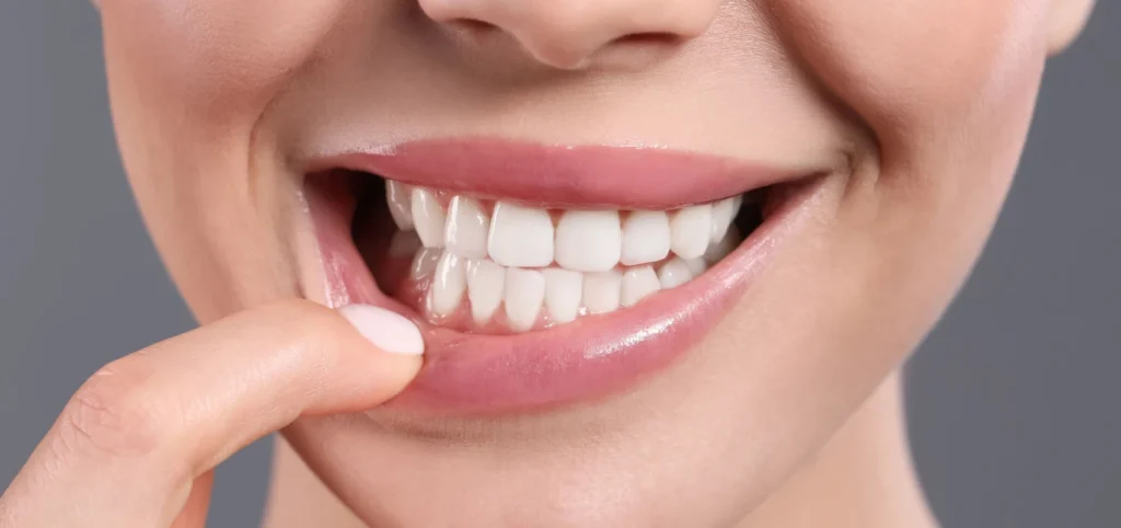 soins gencives detartrage dentiste mulhouse La parodontite : la maladie des gencives  Chirurgiens-dentistes à Mulhouse