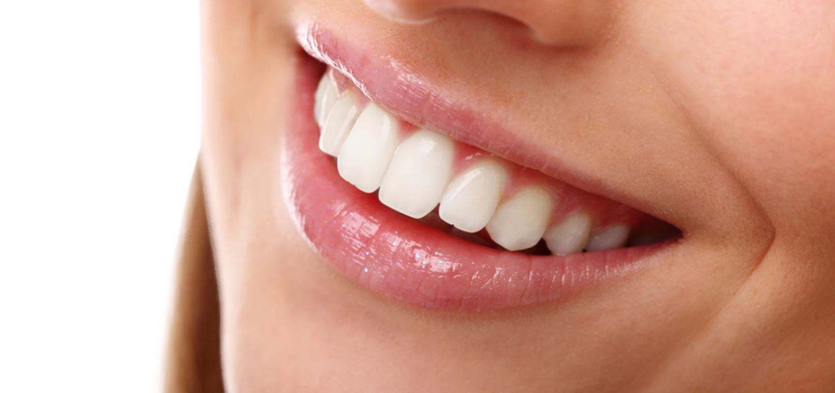 traitement-esthetique-dentiste-mulhouse