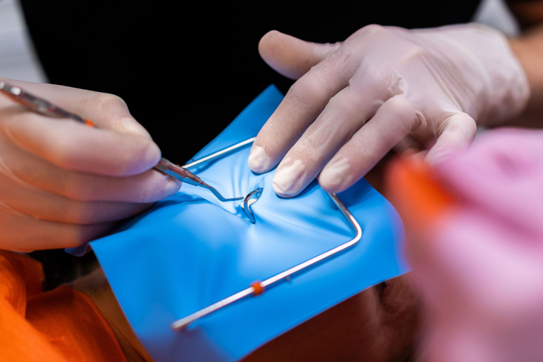 implants digue dentaire